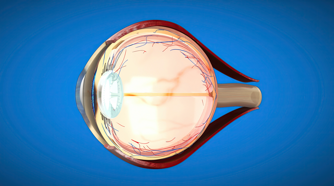 Glaucoma: por qué una revisión de la vista puede salvar tu visión